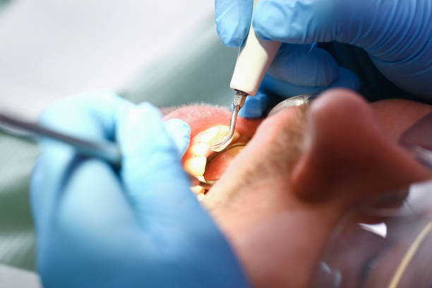 Best Pediatric Emergency Dentist in Payson, UT